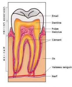 implant